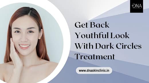 dark circles treatment